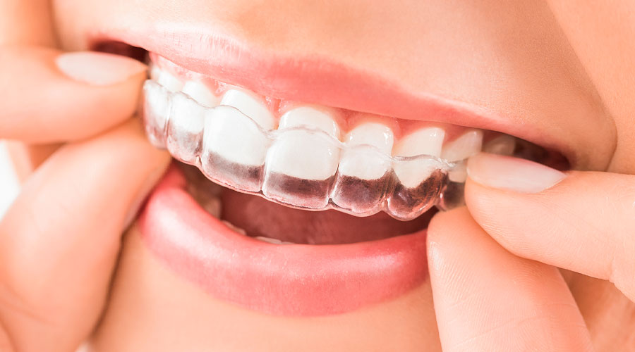 Traitement orthodontique